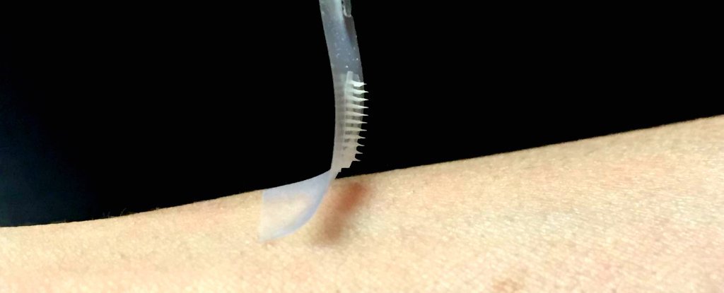 Cientistas criam rem&eacute;dio que pode controlar diabetes sem inje&ccedil;&otilde;es