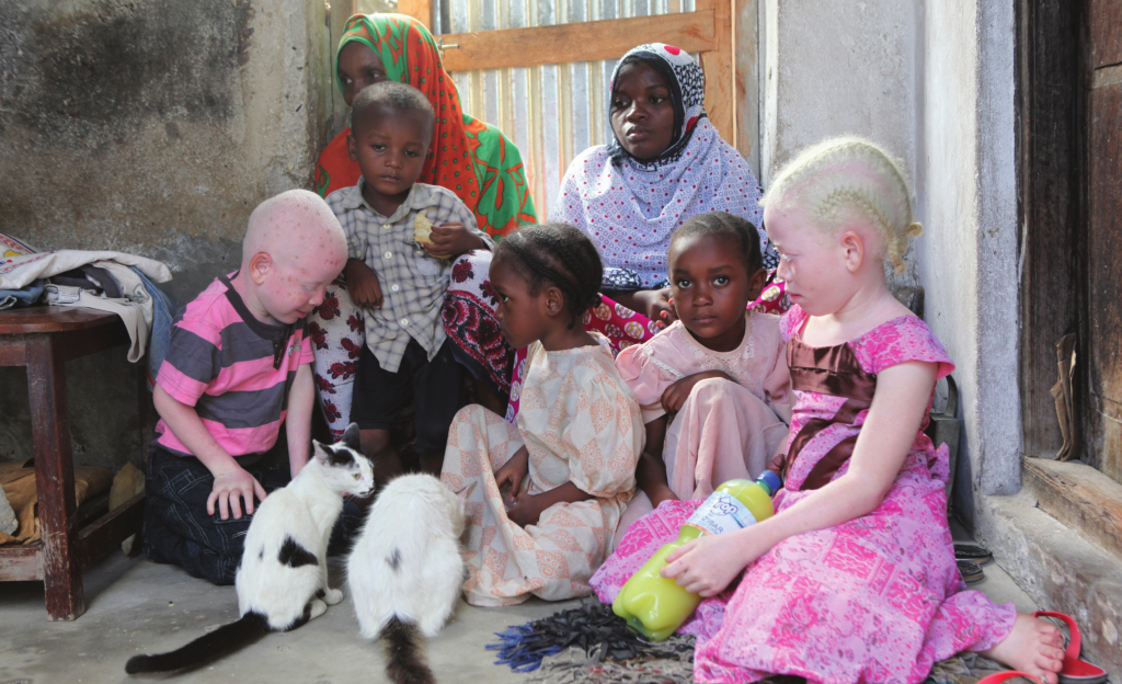 MINORIA RECESSIVA Dos cinco irmãos, dois são albinos. A defciência na produção de melanina aparece em quem tem dois genes recessivos para a doença
